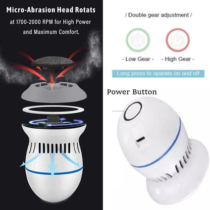 Vakuum-Hornhautentferner