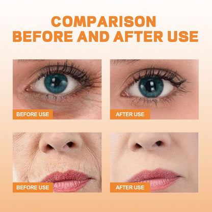 10Stk Kollagen Film Maske