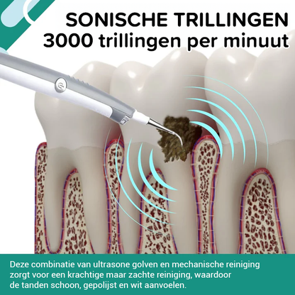 SmileFresh️ | Plaque- und Fleckenentferner