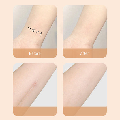 Neue Produkte Ultra-Dünn Tattoo und Narben Concealer Patch